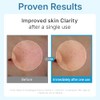 Centellian24 Hyal Waterfull Glow Gel Mask, 5 Piezas
