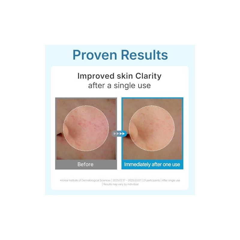 Centellian24 Hyal Waterfull Glow Gel Mask, 5 Piezas