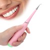 Electric Dental Calculus Remover Plaque Tartar Cleaner Teeth Cleaning Tool