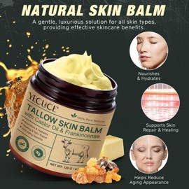 Beef Tallow and Honey Balm for Skin- Organic Grass-Fed Whipped Tallow, Castor Oil, and Frankincense Oil Skin Balm - Deeply Moisturizing for Face & Body - Natural Skin Care for Soft, Supple Skin. 4oz.