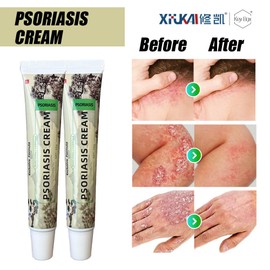 2026 Herbal Skin Care Cream 20g Soothing Anti-Itch Moisturizing Daily Skin Care Cream for Dry Irritated Skin Gentle Hydrating Skin Treatment