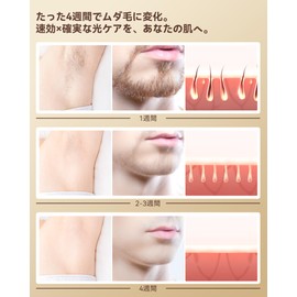 YUNDOO Epilator for Men and Women, Home Epilator VIO/Beard/Underarm/Legs/Arms Full Body Compatible, Maximum Output 19.8J, Instant 5℃ Cooling, 990,000 Shots 9-Level Adjustment, Painless Hair Removal