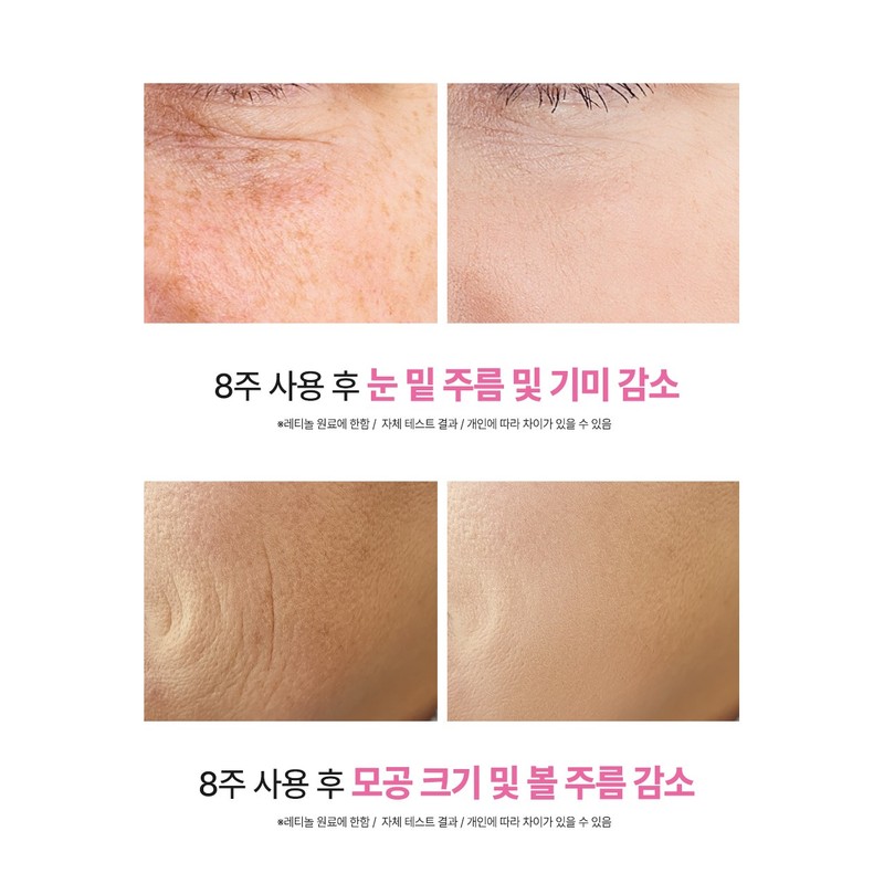 (기미/화이트닝) 빅토나인 리포좀 글루타치온 레티놀 크림 백옥크림 기미 잡티 검버섯