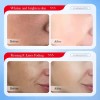 Crema Facial Ácido Kójico + Mascarillas, Manchas Paño Y Sol