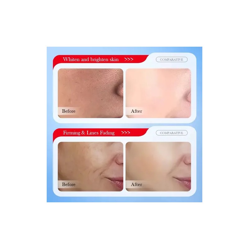 Crema Facial Ácido Kójico + Mascarillas, Manchas Paño Y Sol