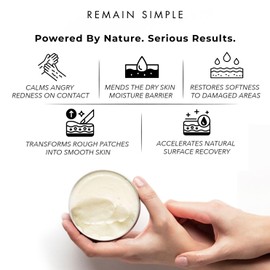 Remain Simple Oregano Oil Balm - Intensive Skin Rescue Salve - Soothes Dry, Cracked & Itchy Areas - Calms Redness & Irritation - Natural Tea Tree & Shea Butter Moisturizer - 2 oz