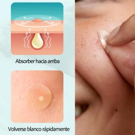 Pimple Patch Hidrocoloide - Parches para Acné Suaves y Discretos