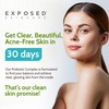 Exposed Skin Care Probiotic Supplement Complex with 1 Billion CFU