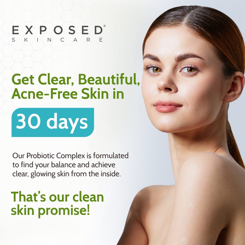 Exposed Skin Care Probiotic Supplement Complex with 1 Billion CFU