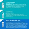 Cerave Acne Essentials Skincare Routine For Acne-prone Skin