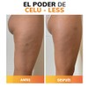 Celu-Less Kilani Crema de Celulitis Super Concentrada - Cafena Pura,
