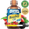 Aceite De Rosa Mosqueta Con Vitaminas A, C Y E