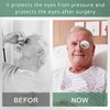 LMYzhijia Adjustable Aluminum Eye Mask Post-Cataract Surgery Recovery Eye Cover