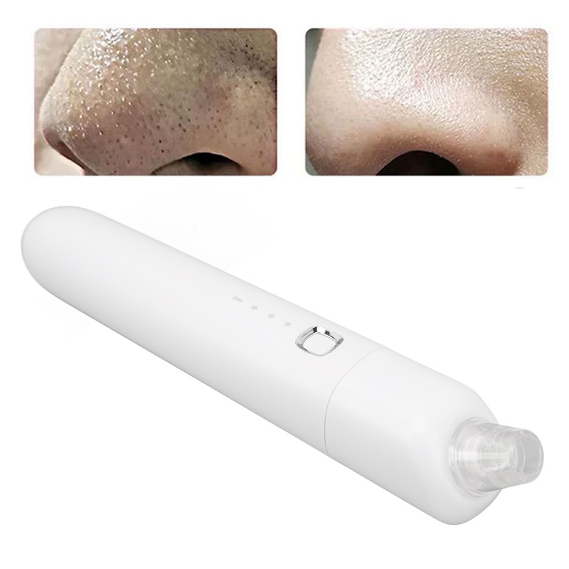 Blackhead Remover Pore Vacuum 3 Suction Power Deep Cleansing Electric