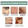 4 Piezas De Suero Hidratante De Colágeno Ren Skin &th