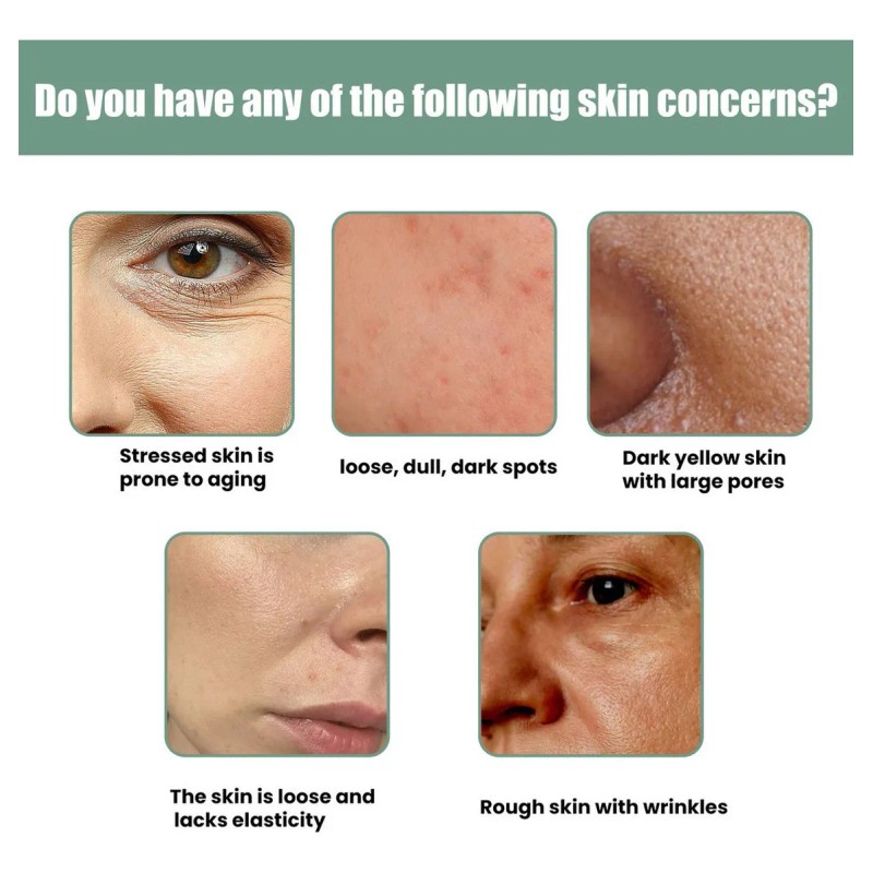4 Piezas De Suero Hidratante De Colágeno Ren Skin &th