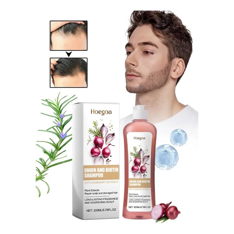Champú De Cebolla Para El Crecimiento Del Cabello 200ml*2