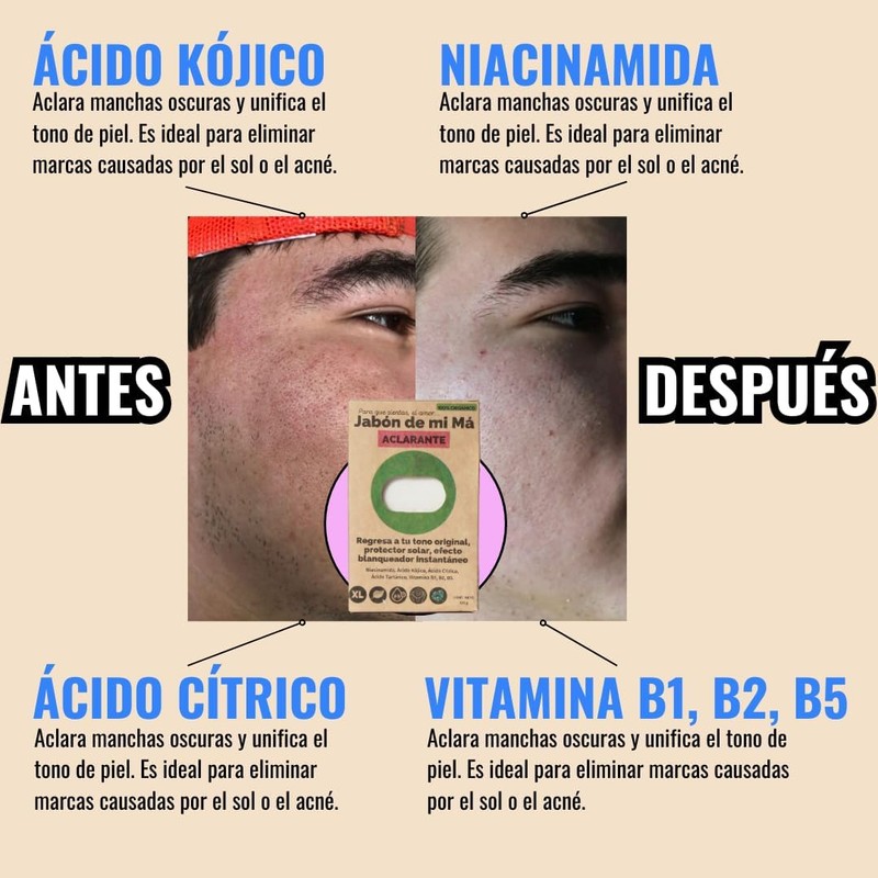 Pack x2 Jabones Aclarantes De Mi Má Ácido Kojico