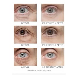 Crema Contorno De Ojos Fsfn Anti-pigment Anti-ojeras 15ml