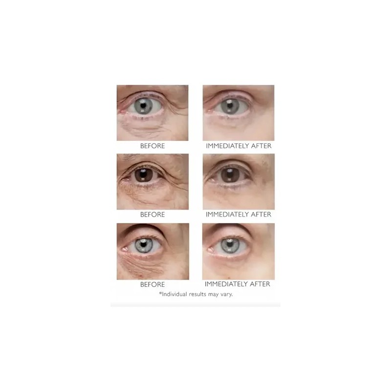 Crema Contorno De Ojos Fsfn Anti-pigment Anti-ojeras 15ml