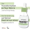 Vitayes 10% Niacinamide & Hyaluronic Acid Serum - Pore Refining,