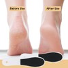 20 Pcs Foot File Callus Remover Double Side Skin Foot