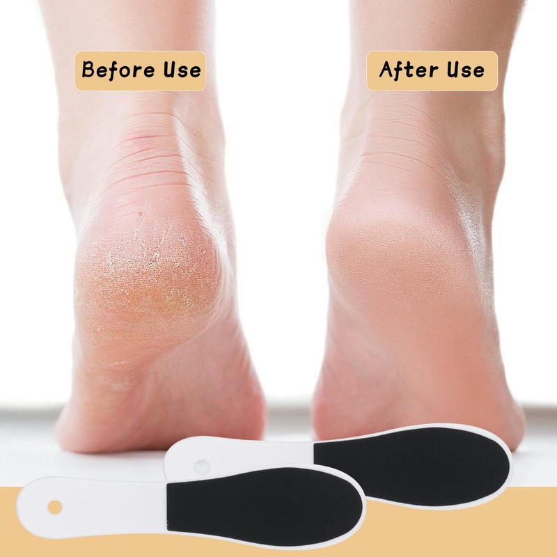 20 Pcs Foot File Callus Remover Double Side Skin Foot