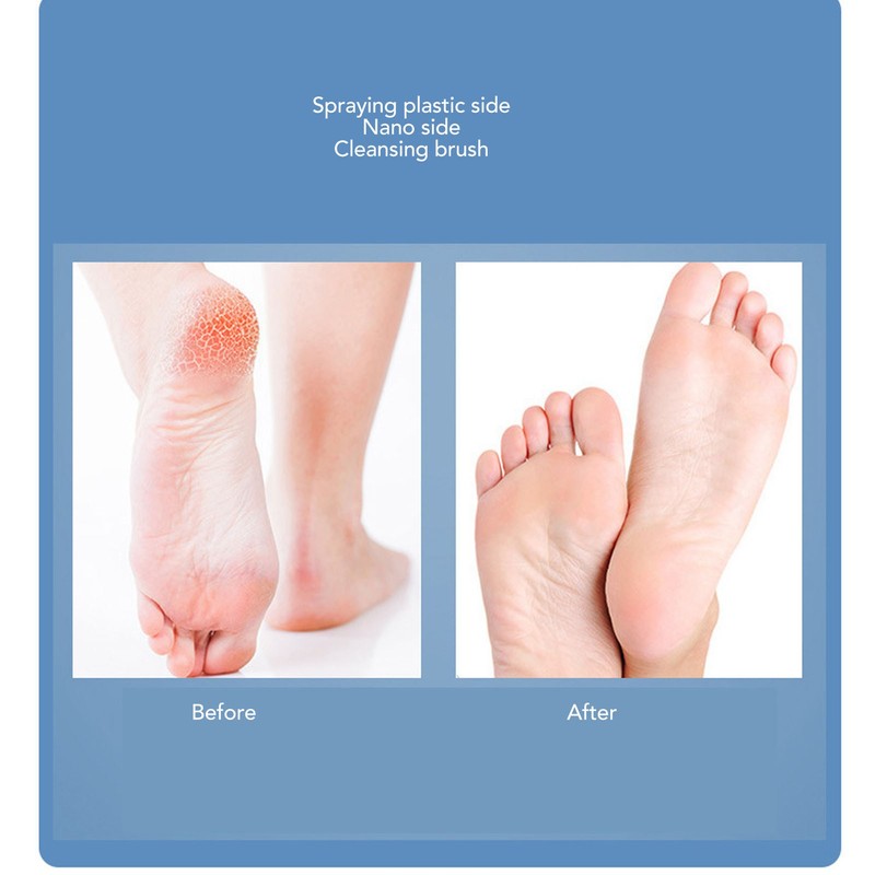 3 in 1 Feet Grinder Remove Callus Dead Skin Foot