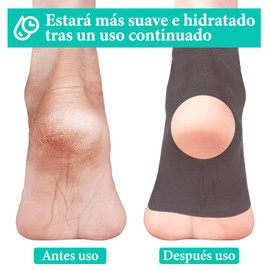 2 Calcetines para el Talón, Calcetines Hidratantes, Forro de Gel Vitaminado, Calcetines de Tacón Suaves y Transpirables, Curar y Tratar los Tacones Secos y Agrietados Mientras Duermes.(Gris)