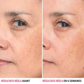 IT Cosmetics Hyaluronic Acid Serum Visibly Plumps Skin & Smooths Lines In 2 Weeks - With Peptide + Vitamin B5 - Vegan Formula - 1 fl oz