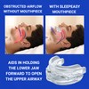 AFFINA sleep easy mouth piece stop snoring device with adjustable