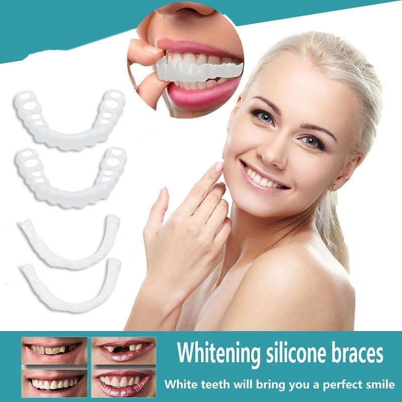 Adjustable Smile Supports - 2 Pairs (Top & Bottom) |