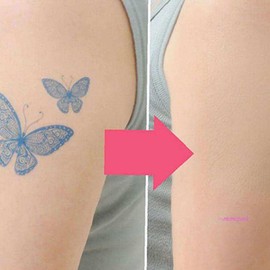 Mimi Shop I01 Cover tattoo cover 3 types scars bruises sheet cover 3rst518 2-1. Large size-pink natural / 커버타투 가리기3타입 흉터 멍 시트 가리기3rst518 2-1.대형사이즈-핑크내츄럴