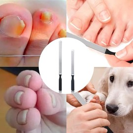 2 Limas Para Uñas De Los Pies Para Uñas Gruesas, Limas De Uñas De Acero Inoxidable Resistentes, Limas Para Uñas Con Mango Antideslizante De 4 Lados, Limas Para Uñas Para Hombres, Personas Mayor