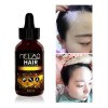 Sérum Para El Cabello Anti Caída Y Crecimiento Capilar 30ml