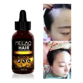 Sérum Para El Cabello Anti Caída Y Crecimiento Capilar 30ml