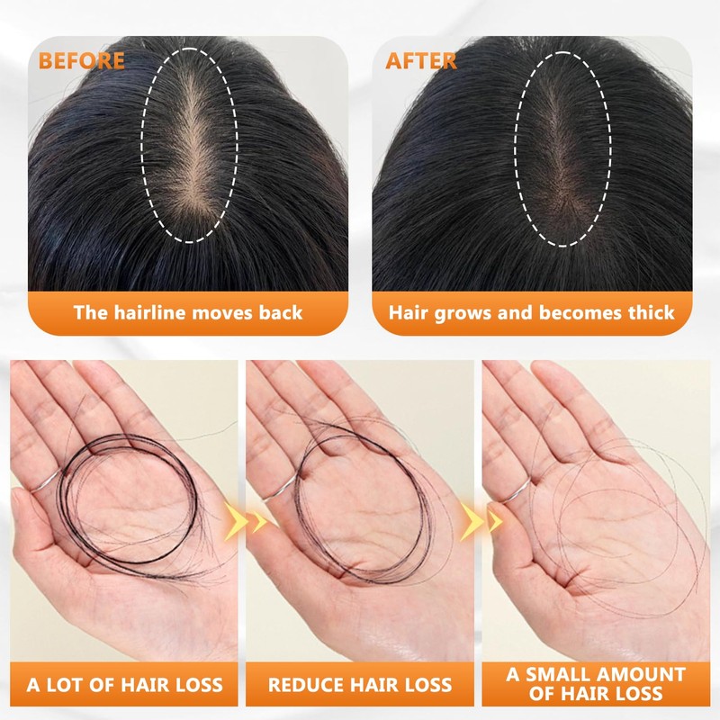 2 PCS Anti Hair Loss Shampoo,Promote Hair Growth, Moisturizing &
