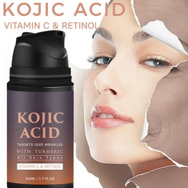 Kojic Acid Gesichtscreme mit Kurkuma - Feuchtigkeitscreme für das Gesicht von Frauen - Kojisäure-Creme Hautaufhellungscreme mit Vitamin C & Retinol - Dunkle Flecken entfernen, Dullness reduzieren