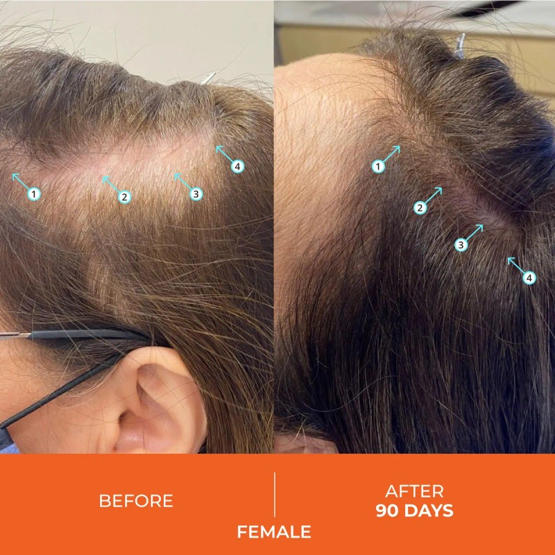 Shampoo Ds Laboratories Revita Para Engrosar El Cabello Para