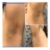 Cremailuminadora Íntima Axilas Codos Manchas Oscuras 60ml Neutra