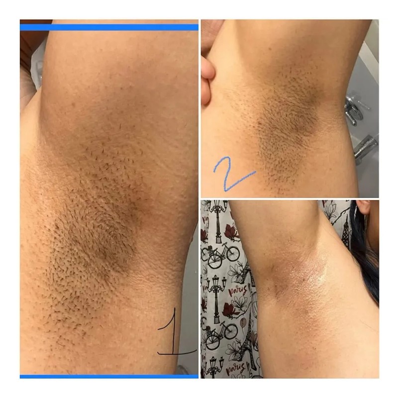 Cremailuminadora Íntima Axilas Codos Manchas Oscuras 60ml Neutra