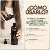 Tonico Vittale Tónico Cabello 75ml Tratamiento Cuero Cabelludo Anticaída Crecimiento