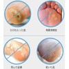 Generic Brands Heel Exfoliating Exfoliating Foot, Stainless Steel Micro Cutter