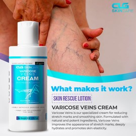 CLG Skincare Varicose Veins Cream - Skin Rescue Lotion for Smoother, Healthier Legs - Advanced Formula for Varicose Veins Improvement, Circulation & Skin Firming, Plant-Based Ingredients, 8 oz (1)