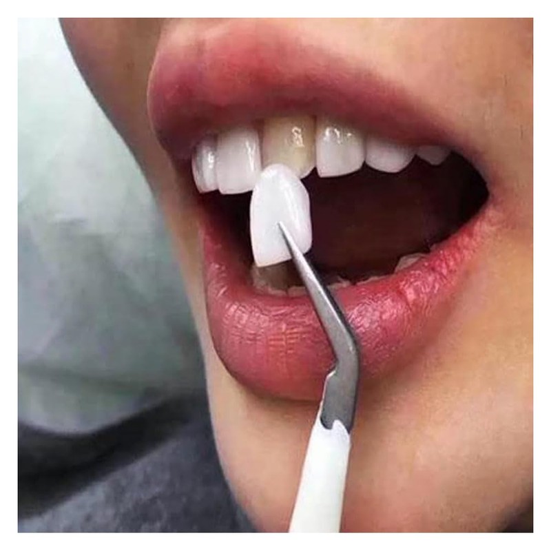Temporary Crown for Front and Rear Teeth Resin Temporary Crown