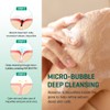 Some By Mi [SOME BY MI] BODY ACNE CLEAR AWAY
