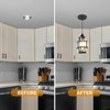 YIIZON 2-Pack Recessed Light to Pendant Converter Kit, Adjustable for