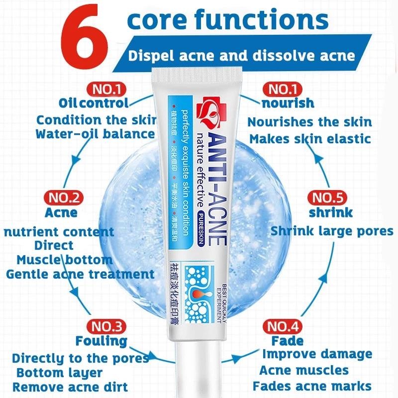 No Brand Real and effective Acne Pimple Cream 祛痘膏祛痘乳霜 20g