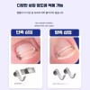 내성발톱교정기 발톱교정기 엄지발톱 내성손톱 [교정기 2개] Ingrown Toenail Correction Device,