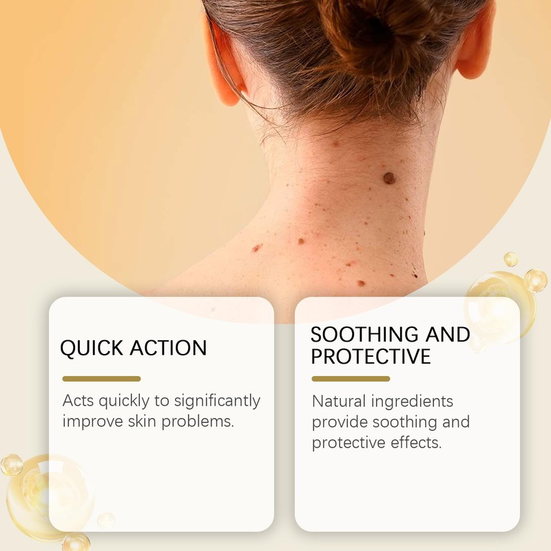 Wart Care Body Cream (01)